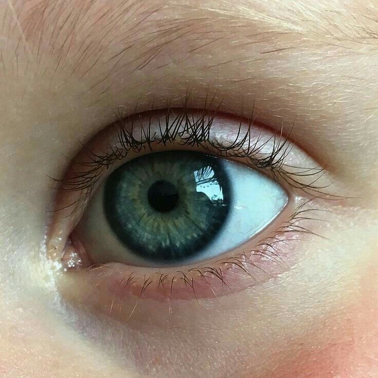 Najlepsza Terapia Strabismusa